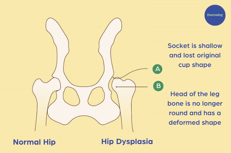 What Hip Dysplasia Looks Like