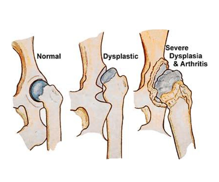 Zoomadog Happy Hips Dog Brace - Excellent for Hip Dysplasia & Hip Weakness